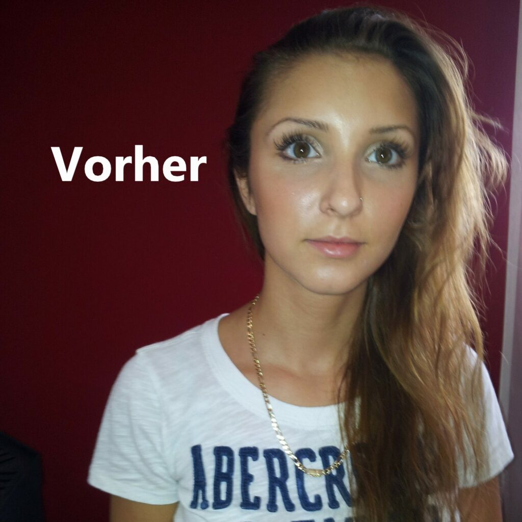 Extensions-vorher